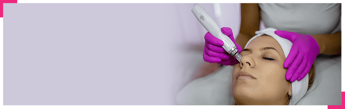Dermapen - czas dla pięknej skóry